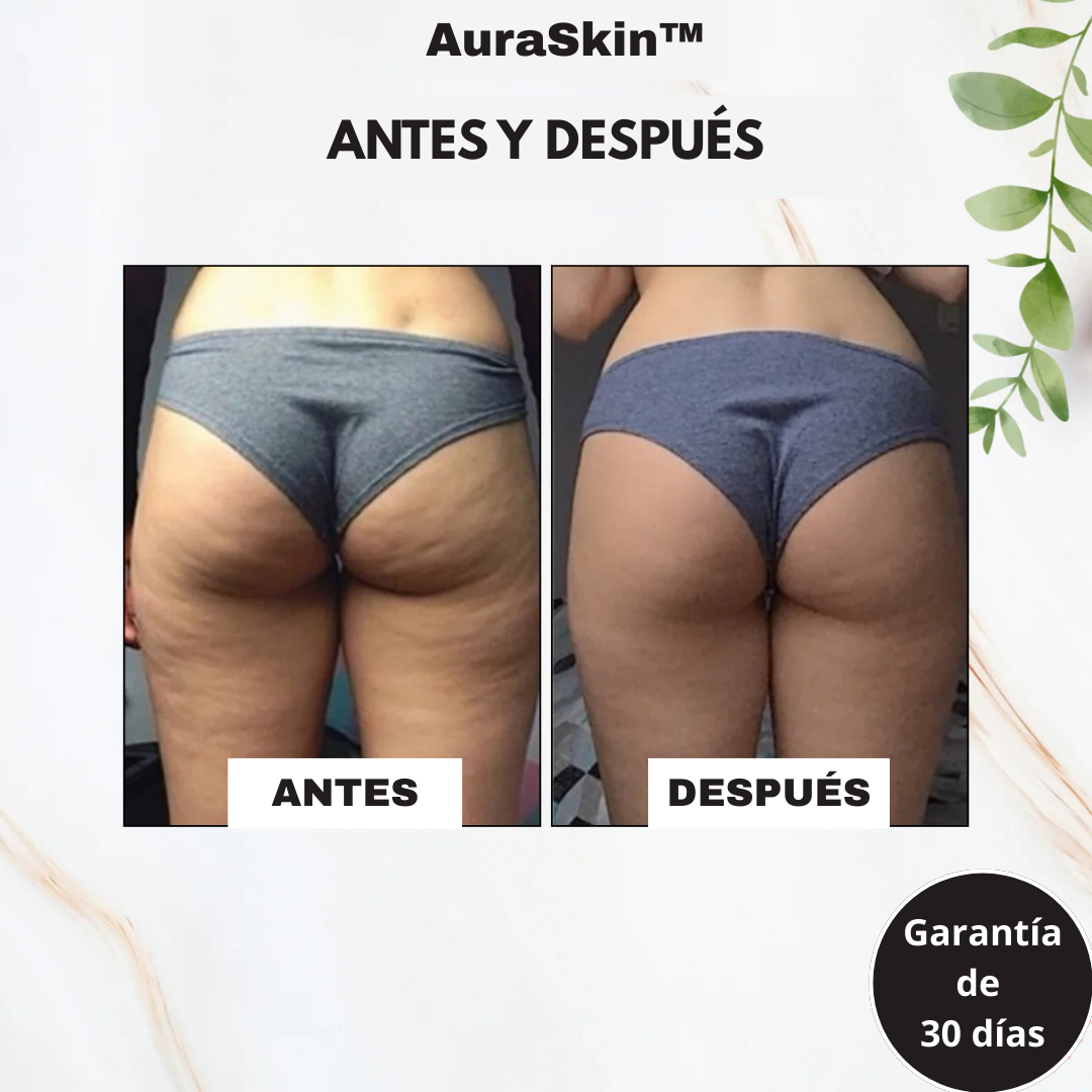 AuraSkin™ - Masajeador Gua Sha Corporal