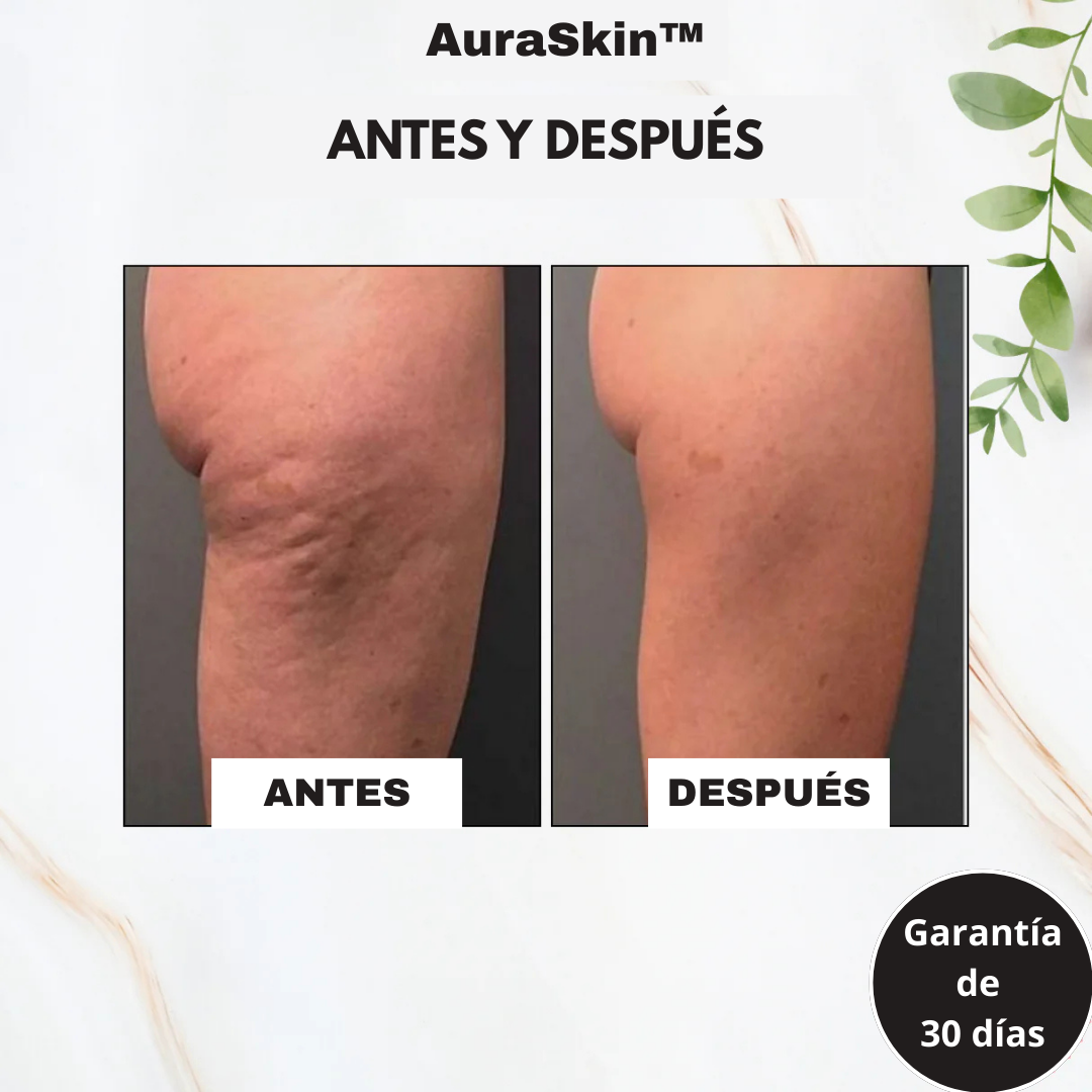 AuraSkin™ - Masajeador Gua Sha Corporal