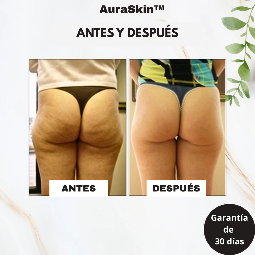 AuraSkin™ - Masajeador Gua Sha Corporal