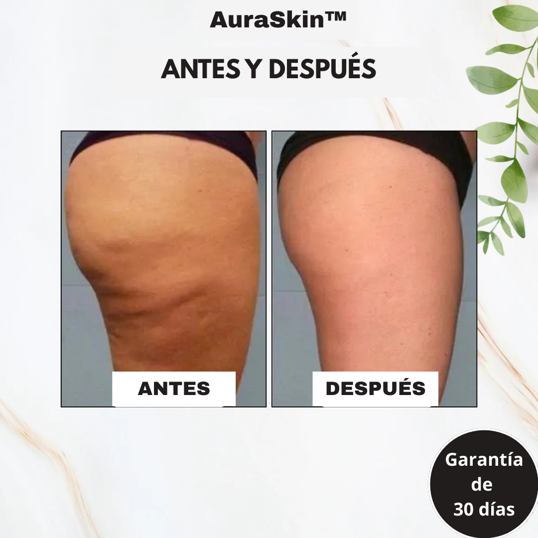 AuraSkin™ - Masajeador Gua Sha Corporal