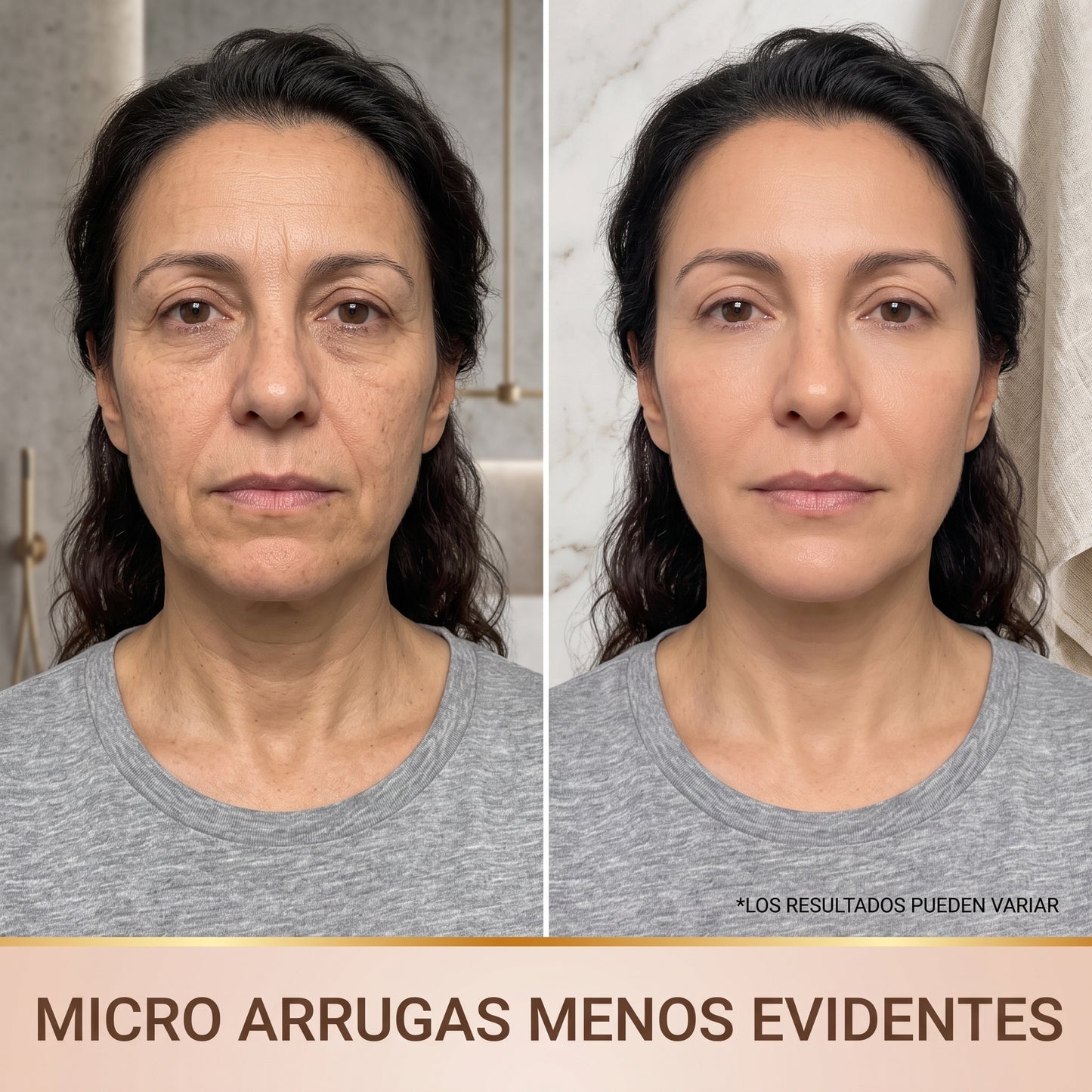Voranex™ - Sérum reafirmante facial