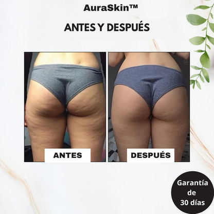 AuraSkin™ - Masajeador Gua Sha Corporal