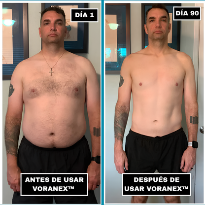 Chaleco Moldeador Voranex™